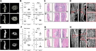 Biglycan regulates bone development and regeneration
